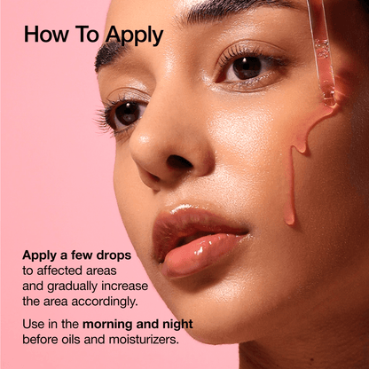 Niacinamide 10 TXA 4 Serum for Brightening and Dark Spots